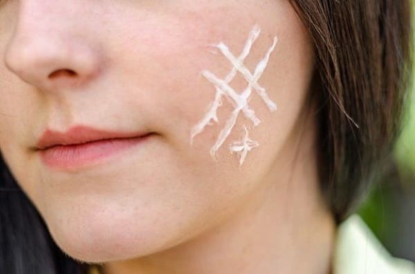 پیشگیری از اسکار صورت