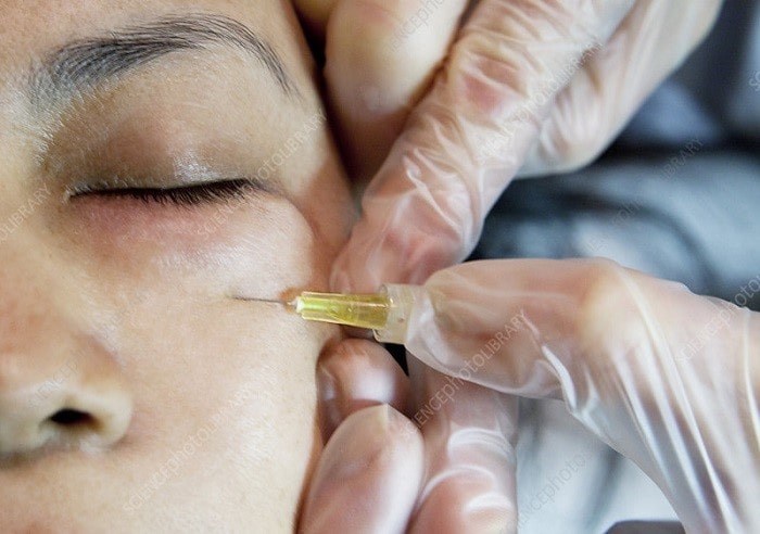 شروع کربوکسی تراپی