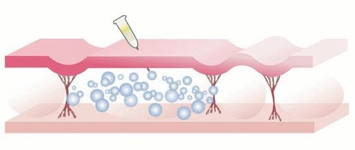 چگونگی کربوکسی تراپی